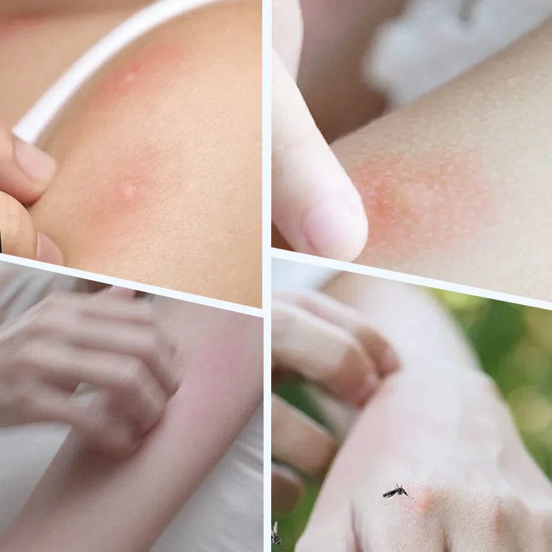Stylish Mosquito Repellent Wristband Buy 1 Get 1 Free