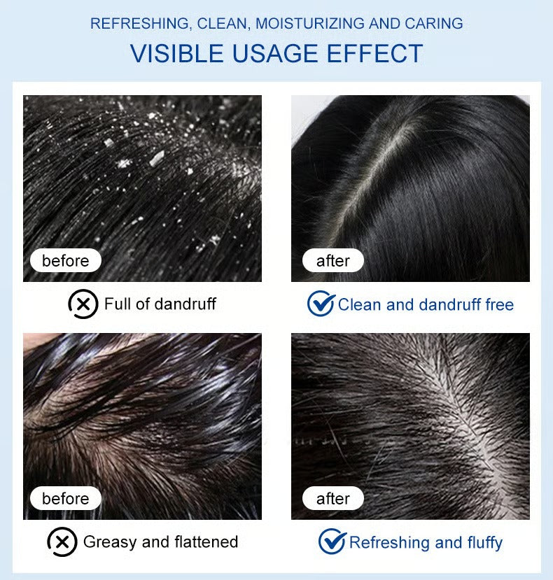 Selenium dioxide shampoo Anti-dandruff, anti-itching, oil control